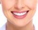 dentes-brancos-sorriso